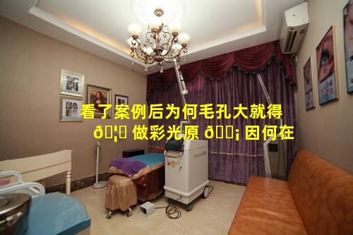 看了案例后为何毛孔大就得 🦊 做彩光原 🐡 因何在